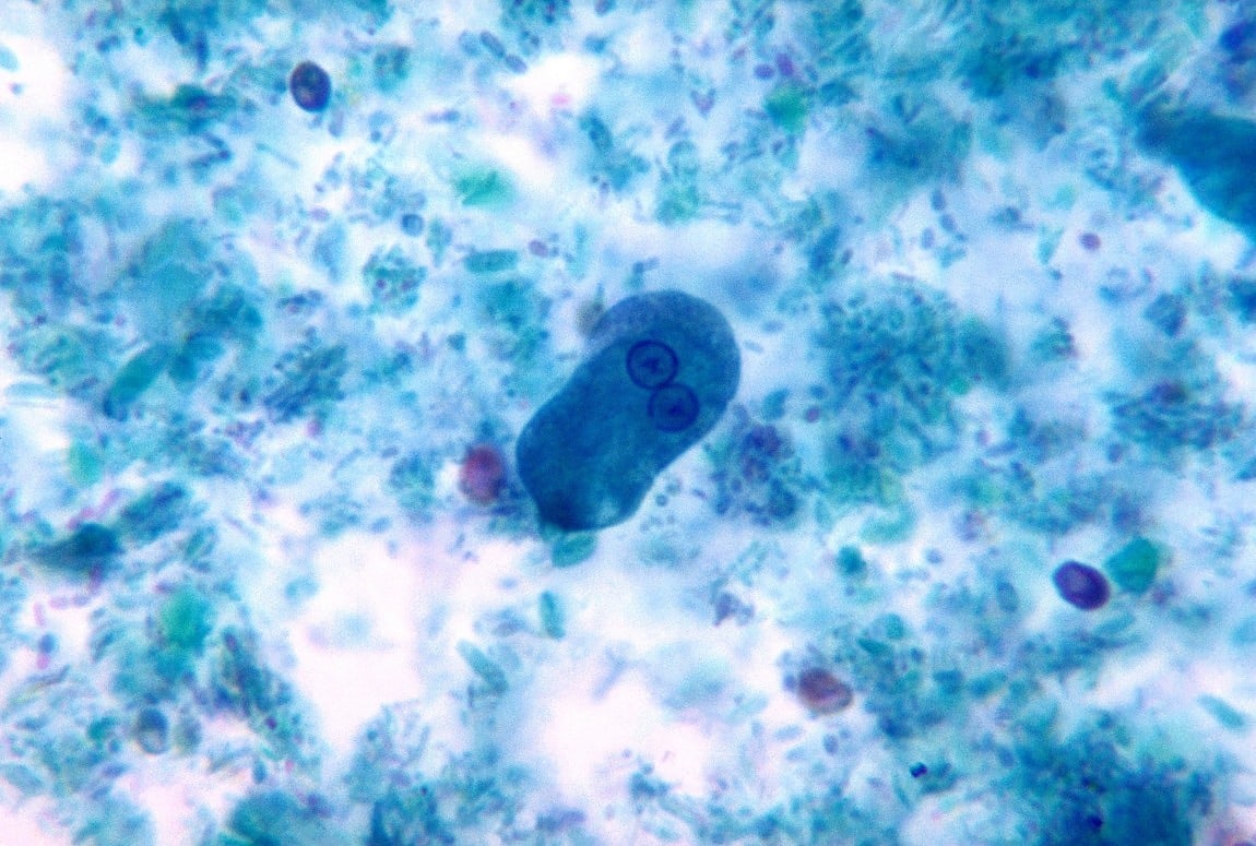 10 Amöbiasis Entamoeba histolytica freie Bilder