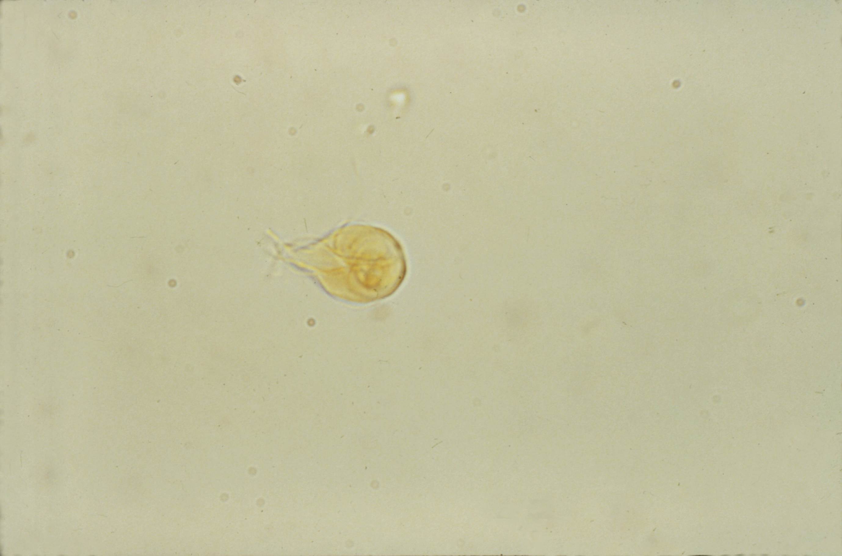 Giardia Lamblia Cyst Under Microscope Micropedia