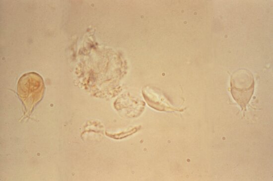 Free Picture Giardia Lamblia Trophozoites Small Intestine Appear Pear Shaped Organisms
