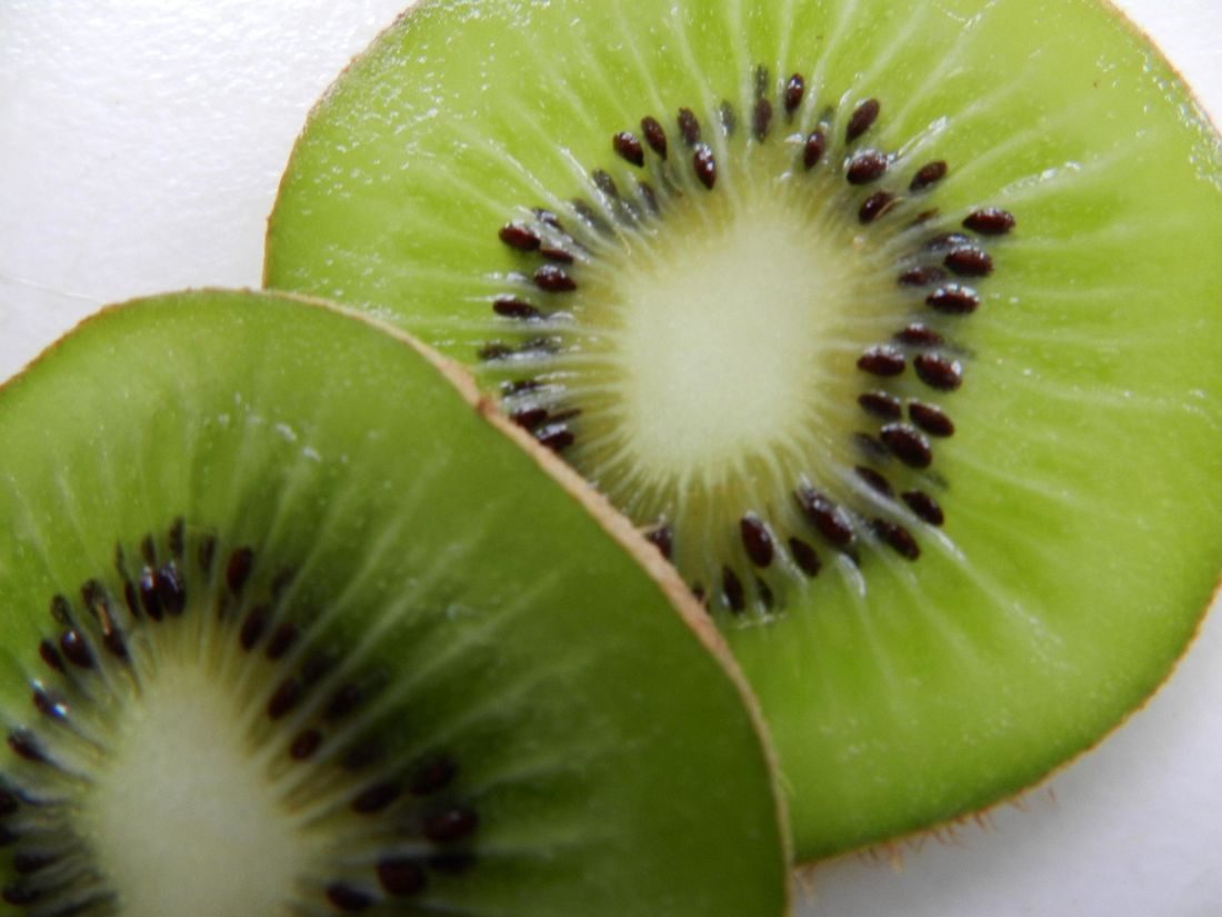 Kiwi, frukt, mat, skive, kosthold, søt, vitamin