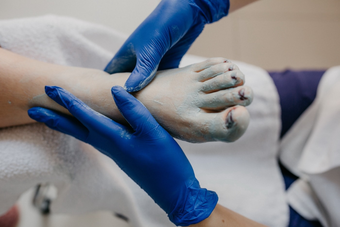 フリー写真画像 裸足 サッカー 病院のベッド マッサージ 病院 医師 女性 手袋 男 手術