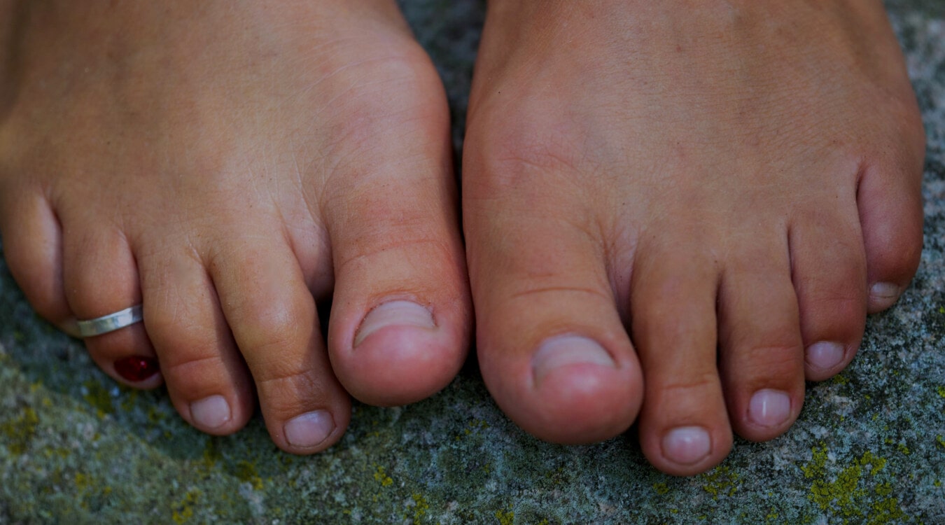 stopy, piękne, palec, pierścień, Toe, boso, skóry, pielęgnacja, człowieka, ciało