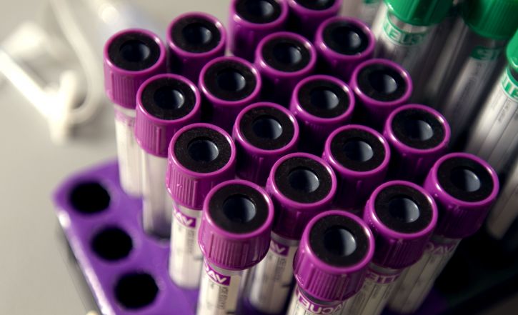 purple, topped, tubes, running, blood, analysis, tests