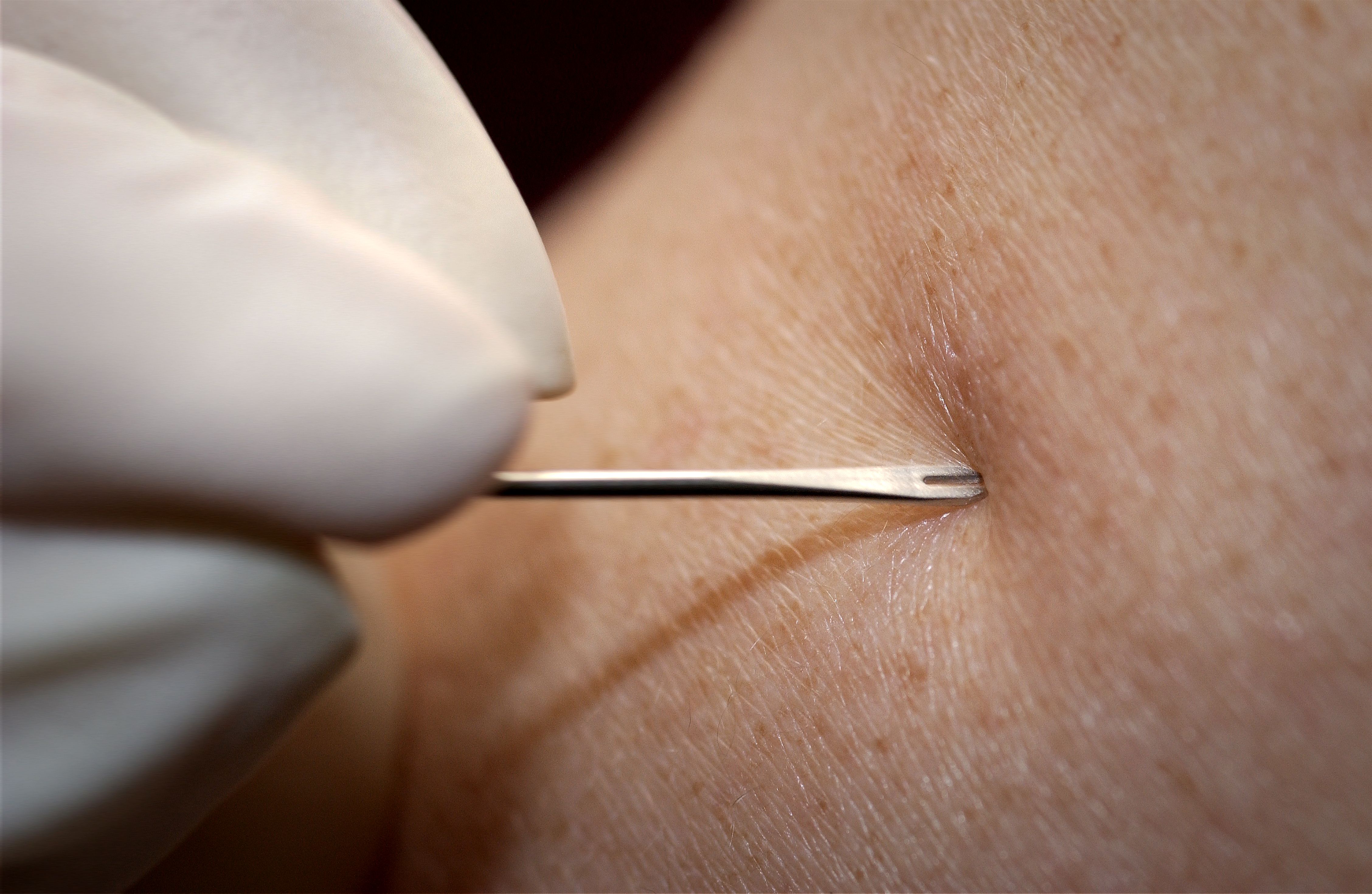 Free Picture Up Close Details Image Bifurcated Needle