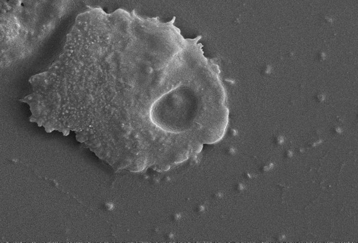 Acanthamoeba, microscópico, ameba
