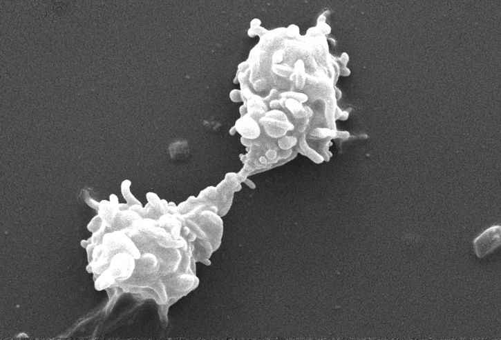 acanthamoeba polyphaga, protozoa, interacting, projecting, pseudopodia