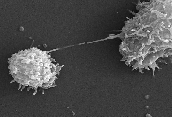 scanning, electron micrograph, two, acanthamoeba polyphaga, protozoa