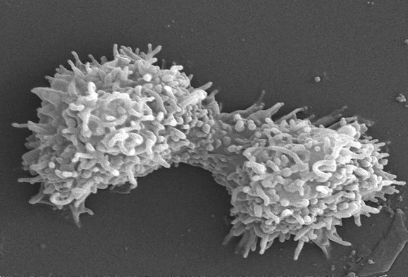 twee acanthamoeba polyphaga, protozoa