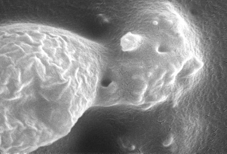 ultrastructural, features, surface, acanthamoeba polyphaga, protozoan, organism
