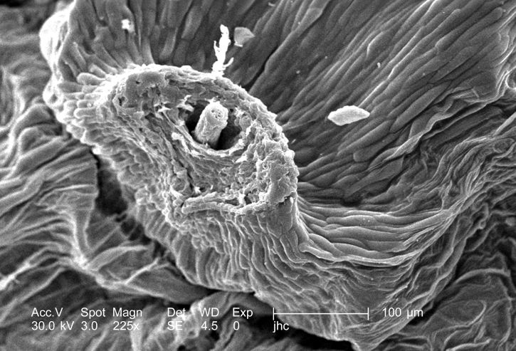 Blowball, cankerwort, mikroskop, zub, endivija