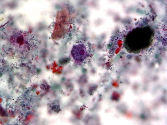 สี trichrome ย้อม trophozoite เดียว เซลล์ ปรสิต entamoeba histolytica