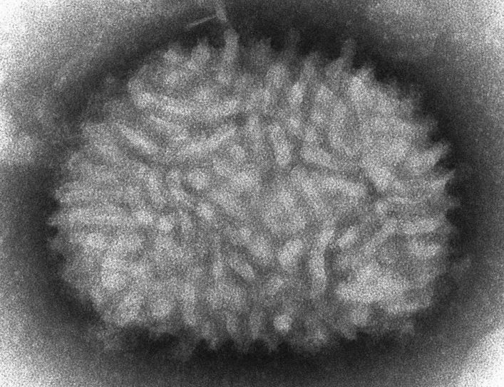 micrographie électronique, la vaccine, le virus