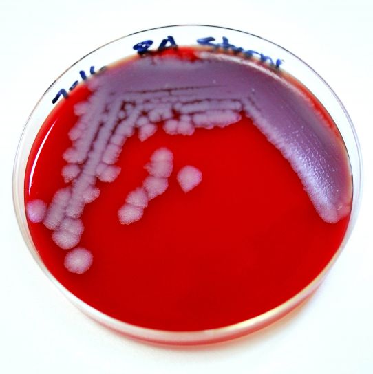 anthrax, spread, one, person, person, anthracis, spores, live, soil, many, years