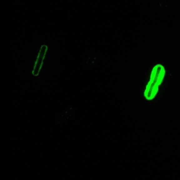 antibody, capsule, stain, bacillus anthracis