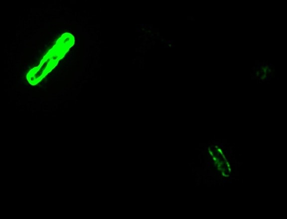 anthracis, direct, fluorescent, antibody, capsule, stain
