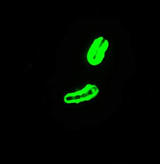 anthracis, direct, fluorescent, anticorps, capsule, tache, 1000x, grossissement