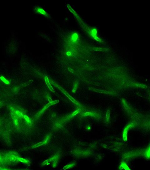anthracis, přímý, fluorescenční, protilátek, buňka, zeď, skvrny