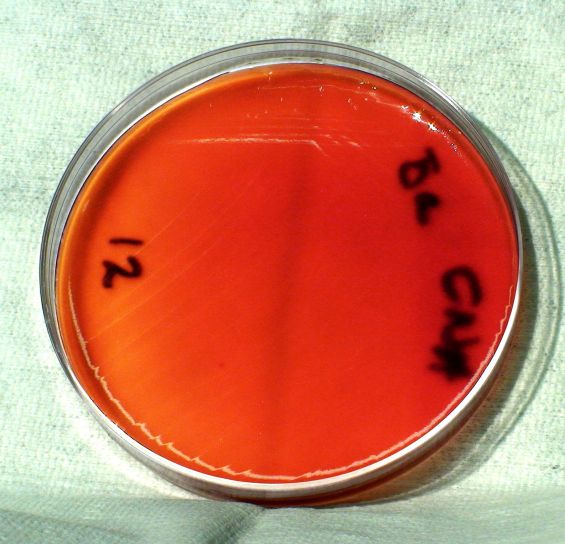 Anthrax, bacteriën, pathogene agens