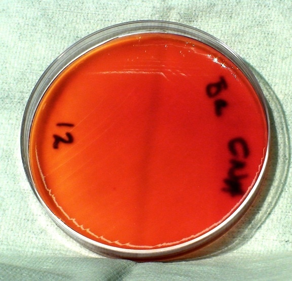 Anthrax, vi khuẩn, mầm bệnh
