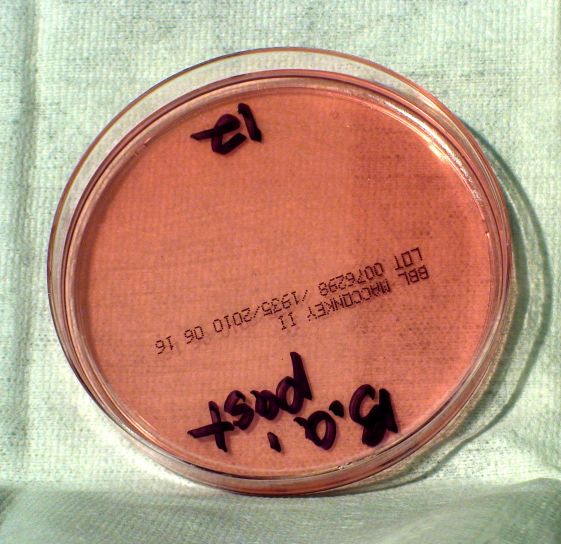 bacilo, anthracis, bacteria, crecido, MacConkey, agar