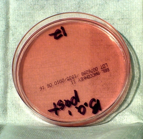 Bacillus anthracis, bakterie, uprawiane, podłożu MacConkey'a, agar