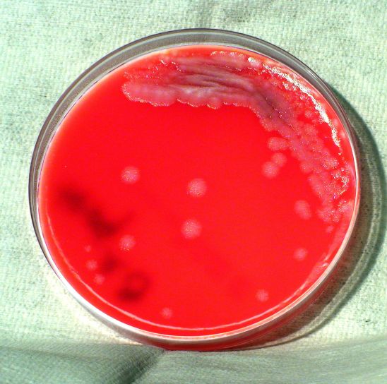Bacillus anthracis, bacteriën, gegroeid, phenylethyl, alcohol, agar