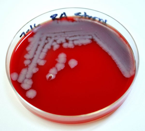 芽孢杆菌, 炭疽菌, 细菌, 菌落, 生长, 血琼脂, 期