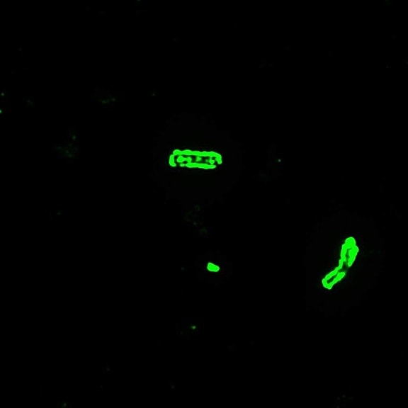 Bazillus, anthracis, direkt, fluoreszierend, Antikörper, Mikroskopie
