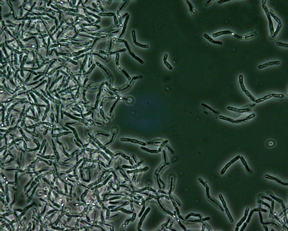 bacillus anthracis, endospores, giai đoạn, tương phản, kính hiển vi, nhẹ hơn, các khu vực
