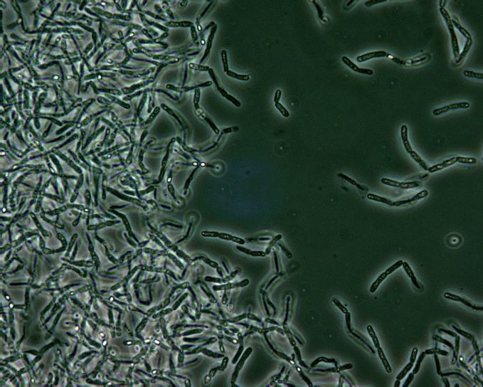 Bacillus anthracis, endospory, fáze, kontrast, mikroskopie, zapalovač, oblasti