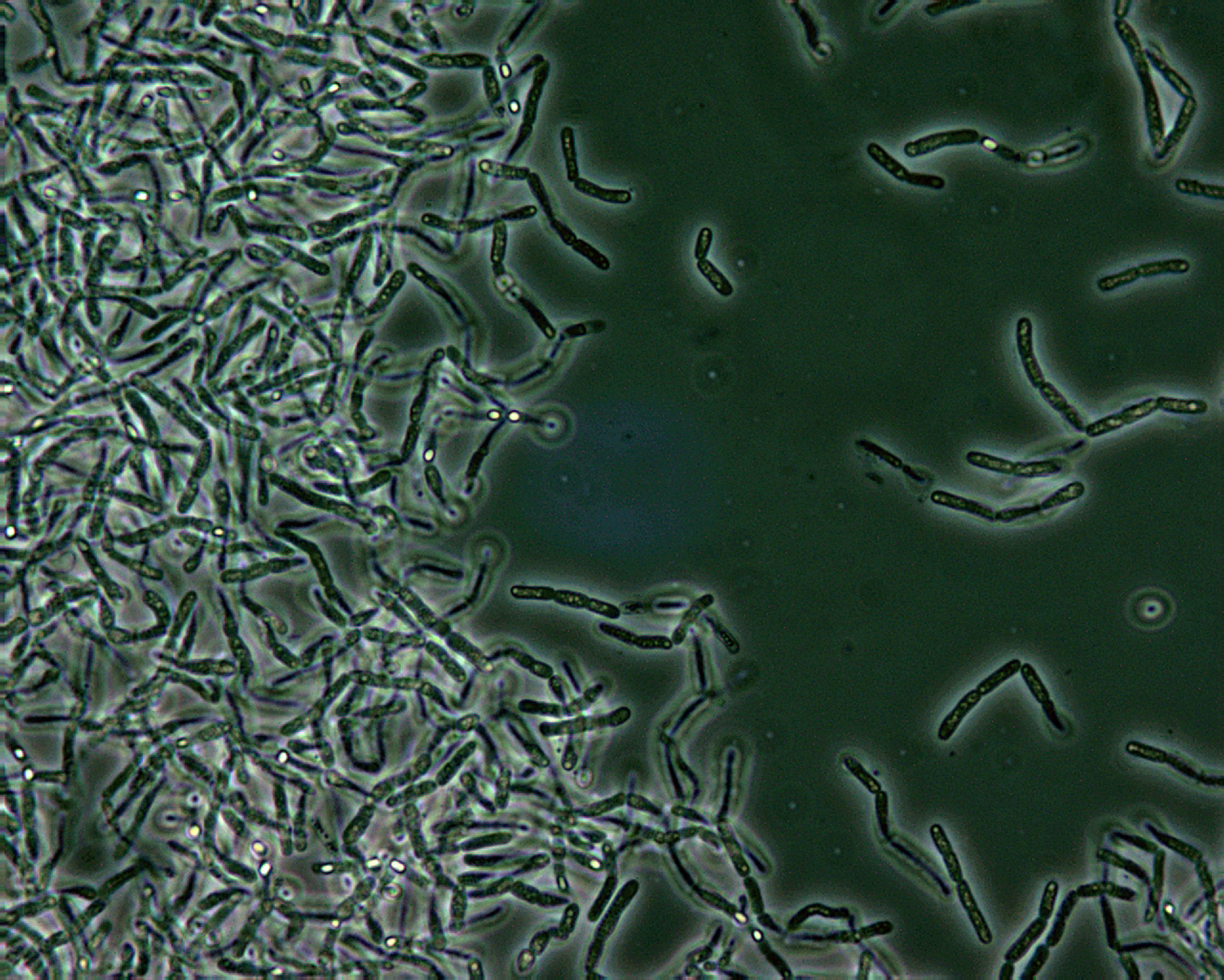 Клетка язвы. Bacillus anthracis микроскопия. Бациллы сибирской язвы микроскопия. Bacillus anthracis Сибирская язва.