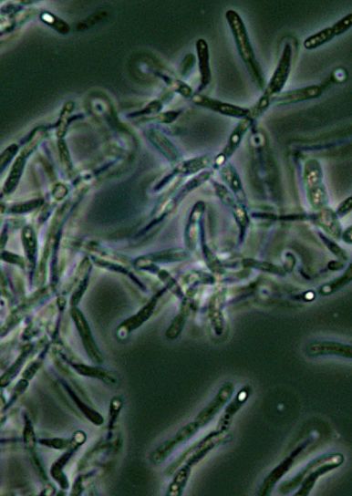 Bacillus anthracis Endospory, fazy, kontrast, mikroskopii