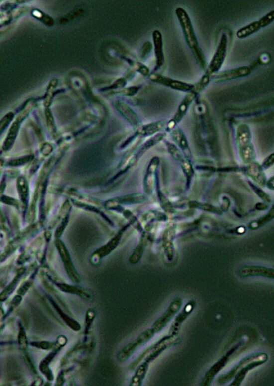 Anthrax Bacillus anthracis