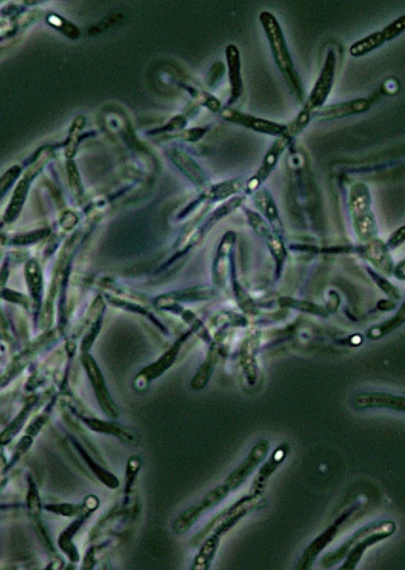 Bazillus, anthracis, endospores, Phase, Kontrast, Mikroskopie
