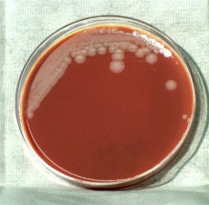 Free picture: bacillus anthracis, bacteria, grown, phenylethyl, alcohol ...