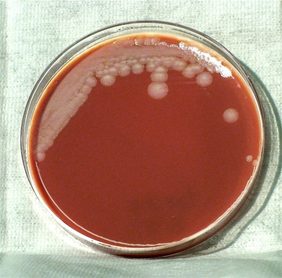 芽孢杆菌, 炭疽, 不能运动, 有氧, 孢子, 形成, 细菌, 棒