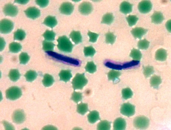 Bacillus anthracis, mfadyean, κάψουλα, λεκές, καλλιεργούνται, βαθμούς Κελσίου, defibrinated, άλογο, αίμα