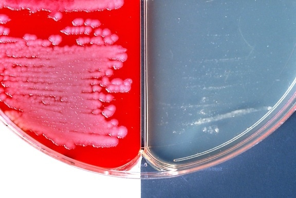 Bacillus anthracis positiva, inkapsling, test, visat, två, olika, agar, media