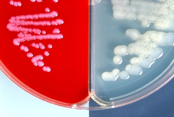 Bacillus сибірської виразки позитивних, інкапсуляція, тест, грубий, колоній, кров Агар, гладкою, колоній, бікарбонат, Агар