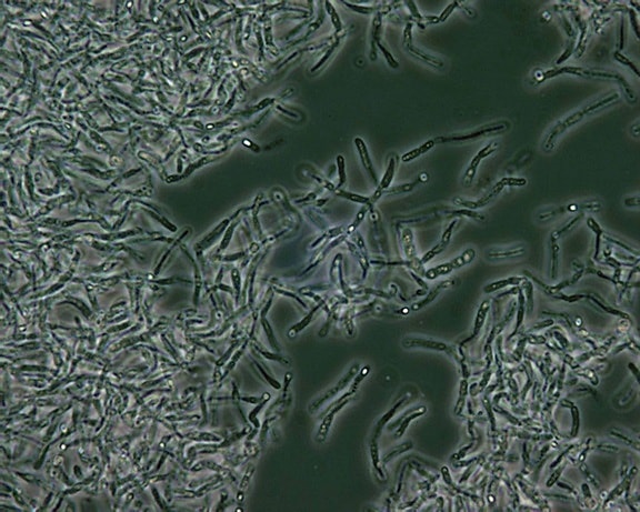Bazillus, anthracis, Sporen, Phase, Kontrast, Mikroskopie
