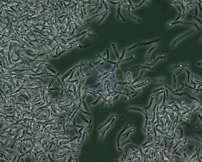 Bacillus anthracis, спори, фаза, контраст, микроскопия