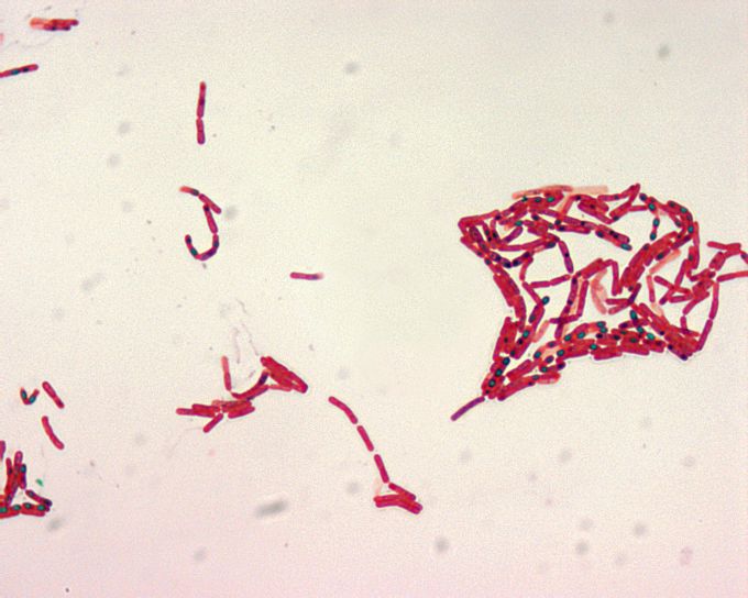 Bacillus, малахіт, зелений, spore, пляма, 1000 x, масштаб