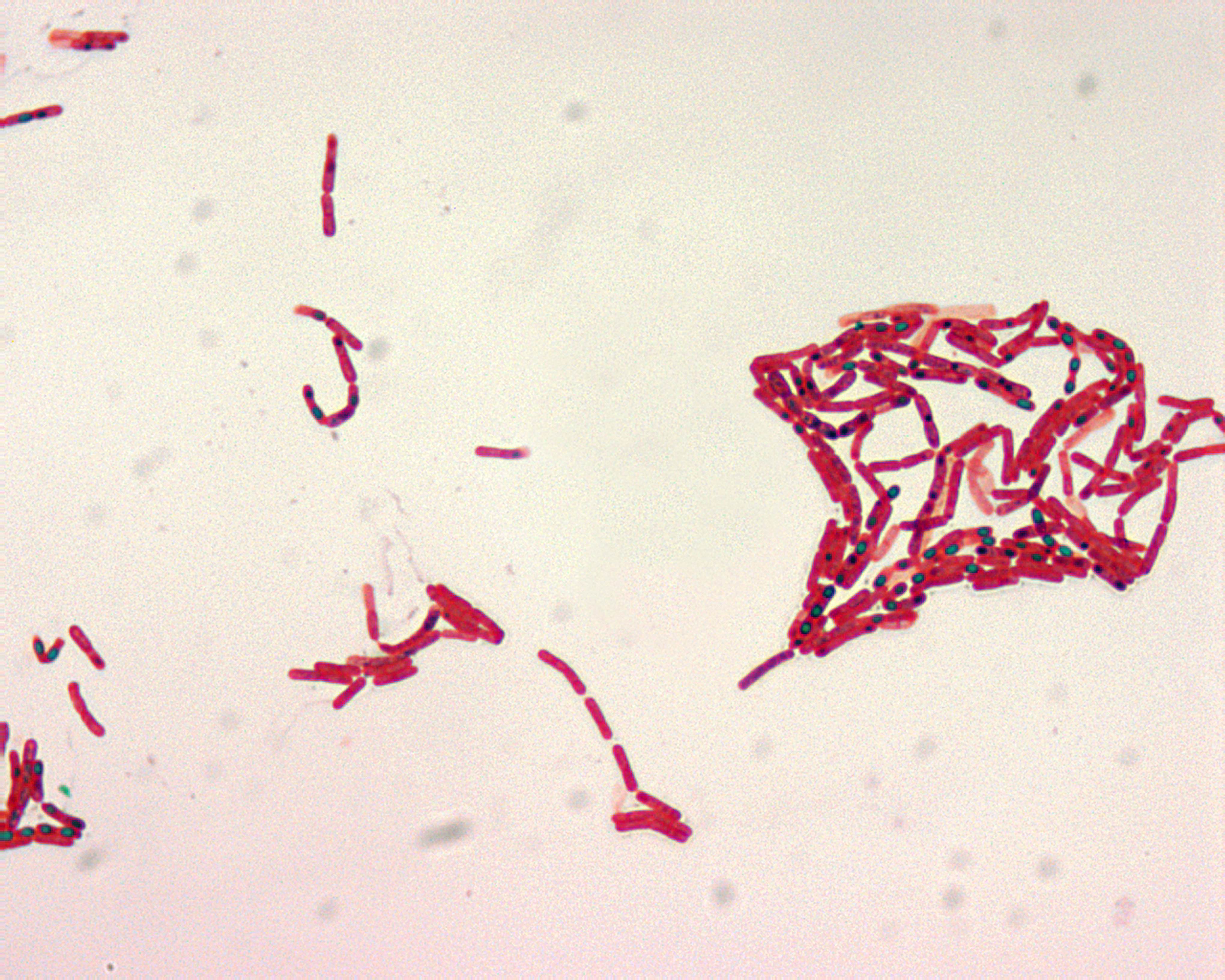 bacillus megaterium spore stain