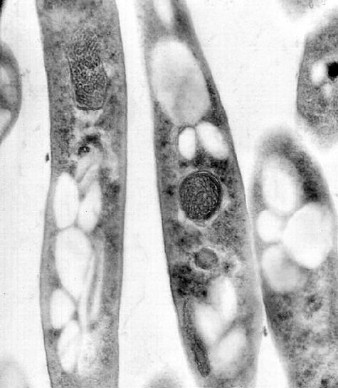 fekete-fehér, kontraszt, Fénykép, továbbítása, elektronmikroszkópos felvétele, bacillus anthracis