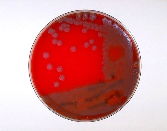 gélose au sang, plaque, culture, bacillus anthracis