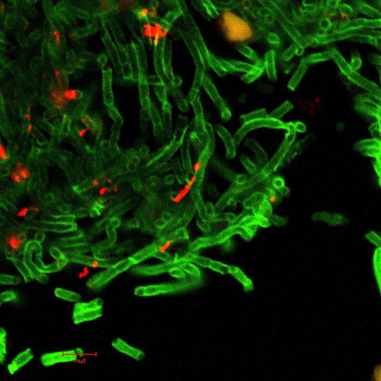 AC confocal, micrographic, bilde, bacillus anthracis, celle, vegger, vises, grønn, sporer, vises, rød
