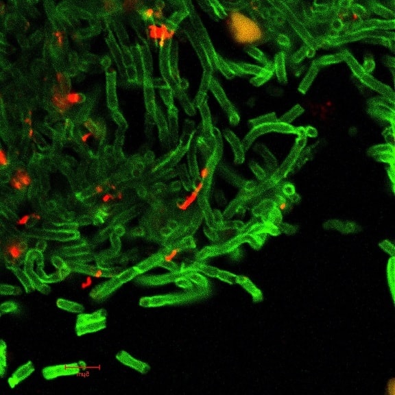 confocal, micrographic, image, bacillus anthracis, cell, walls, appear, green, spores, appear, red