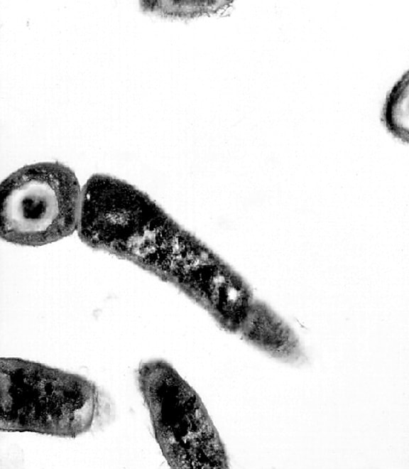 electron micrograph, bacillus anthracis, black and white photography