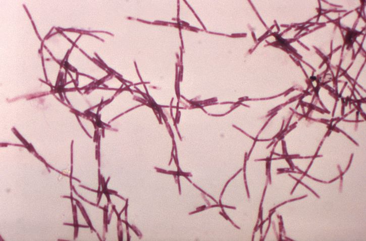 กรัม photomicrograph มากมาย บาซิลลัส anthracis แบคทีเรีย