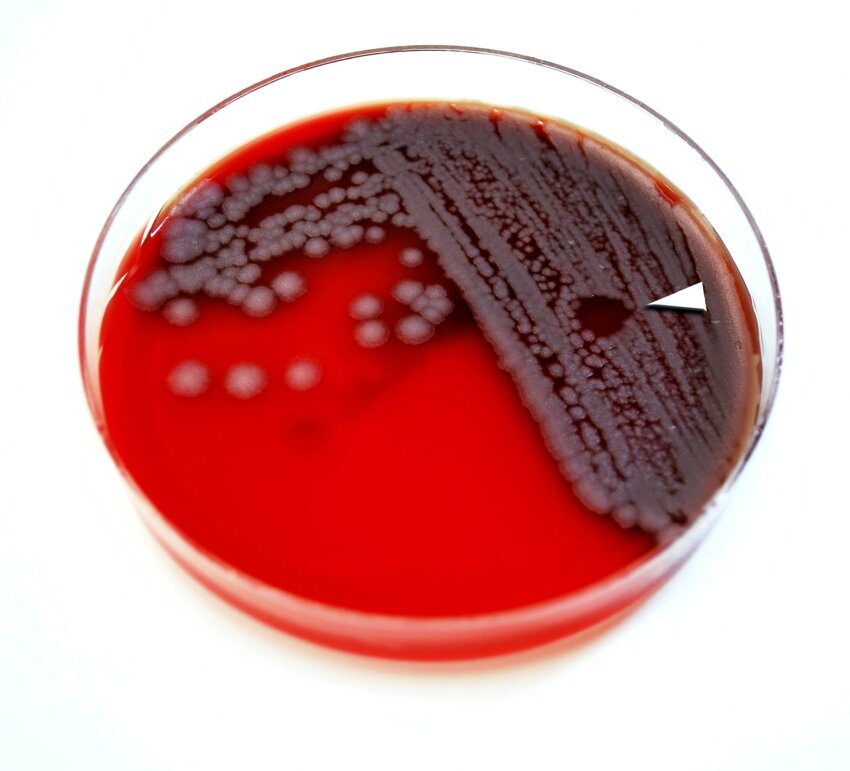 50+ Anthrax Bacillus Anthracis Free Images